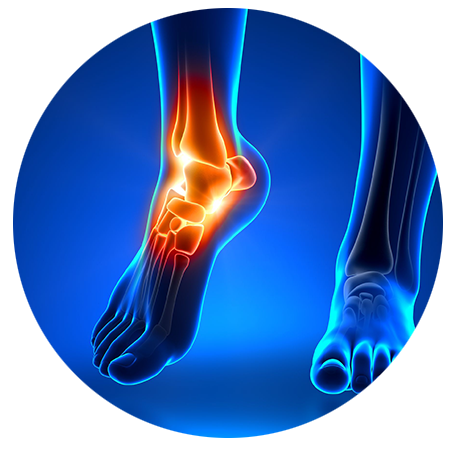 diabetic nerve pain in foot