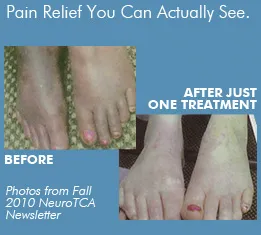 diabetic nerve pain in foot